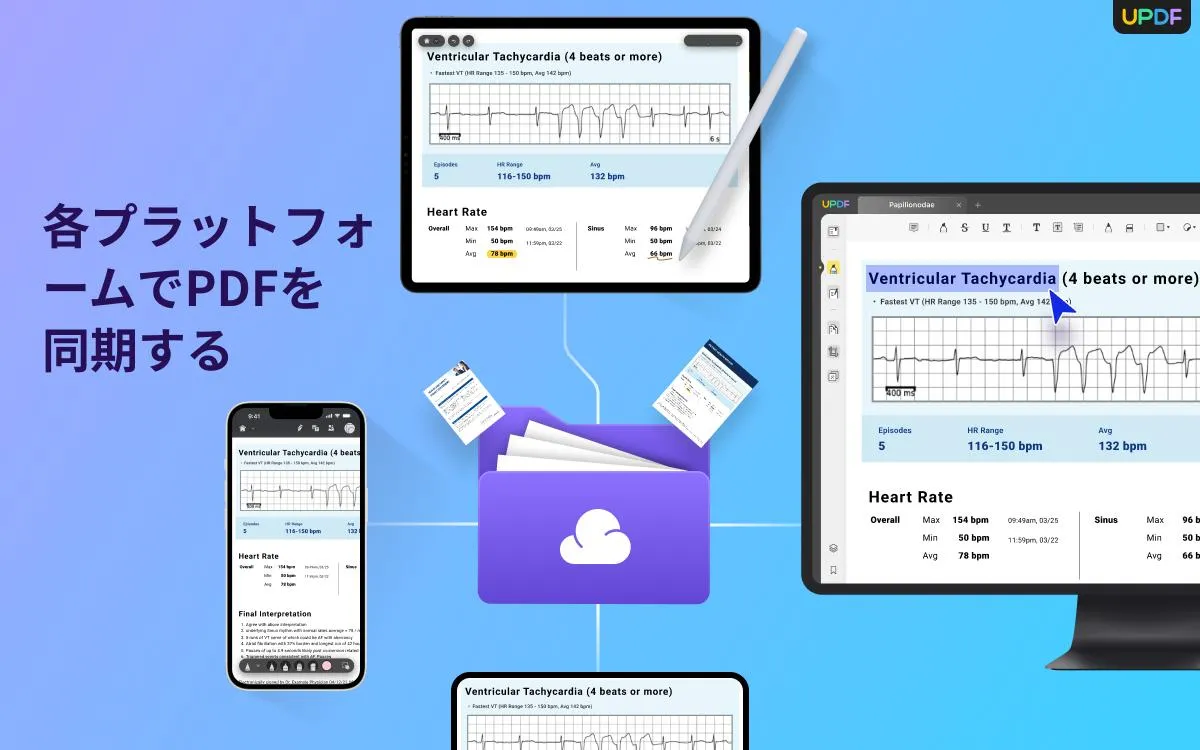 ファイルをクラウドにアップロード